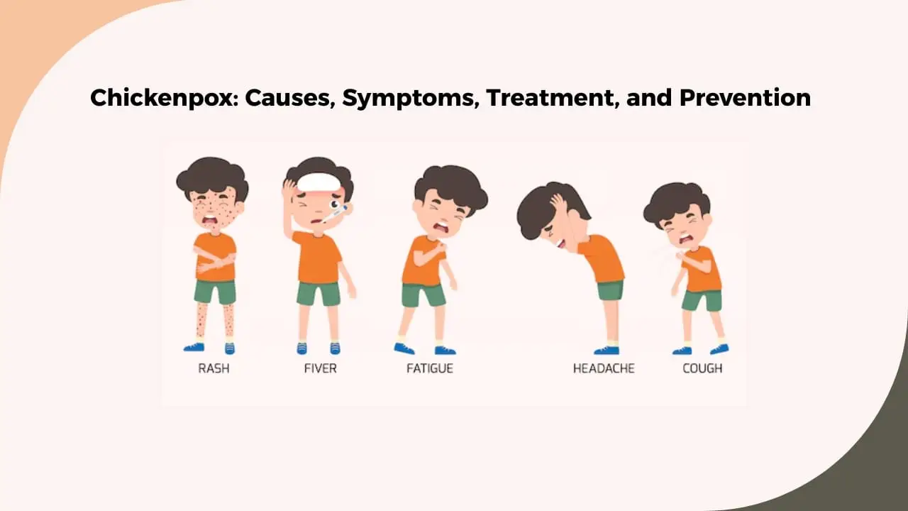 Chickenpox Causes, Symptoms, Treatment, and Prevention